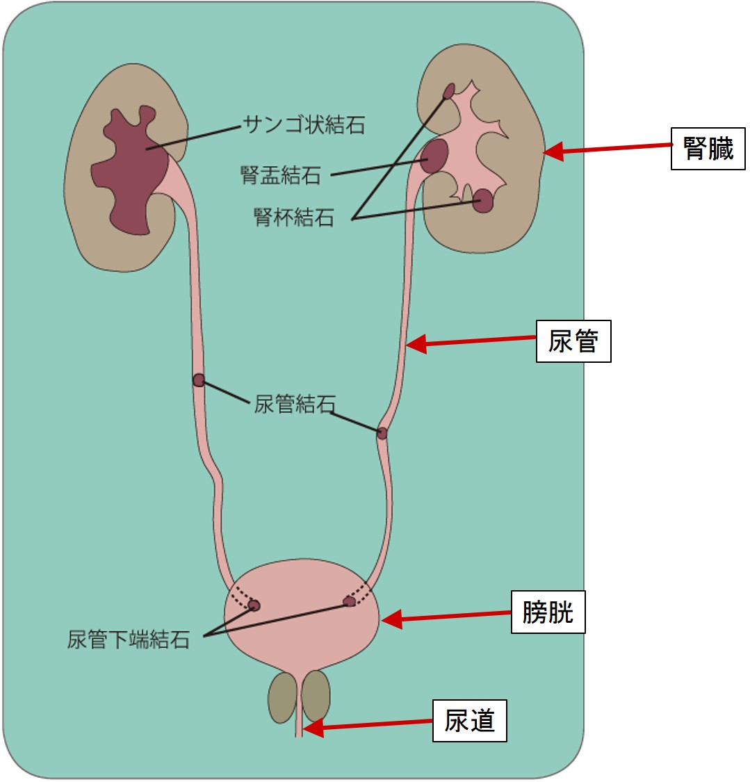 体外式結石破砕装置 放射線部用｜総合病院 水戸協同病院